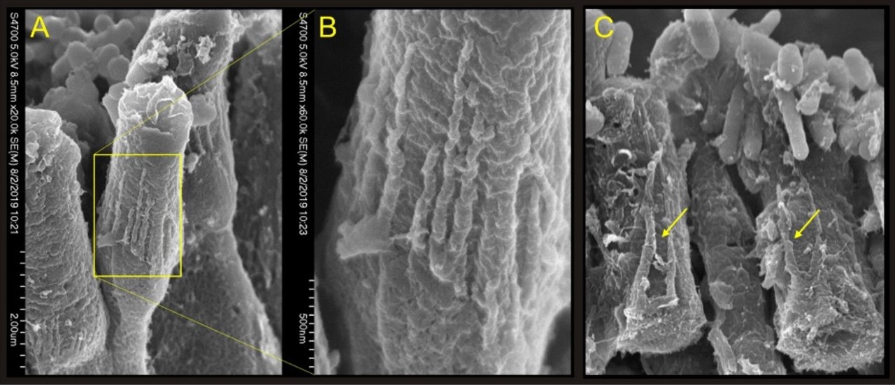 Pathology of photoreceptors in pcdh15b knockout zebrafish