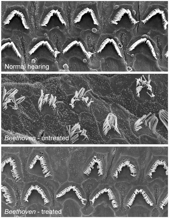 Rescue of hair bundle morphology in apical cochlear sensory epithelium of Beethoven mice.
